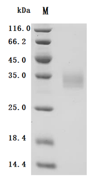 Recombinant Human Galectin-3 (LGALS3)