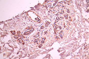 PIP Antibody