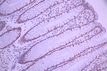 RNF40 Antibody