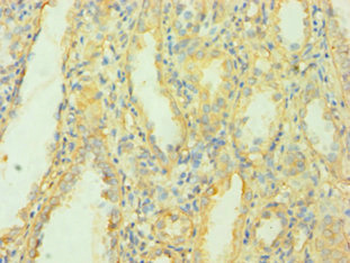 MCPH1 Antibody