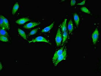 MCPH1 Antibody