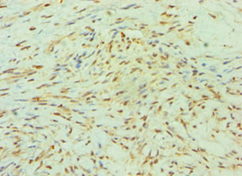 SMYD3 Antibody