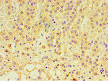 GTF2H2C Antibody