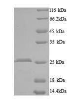 Mouse Wisp2 protein