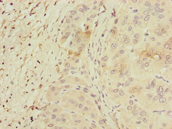PPM1D Antibody