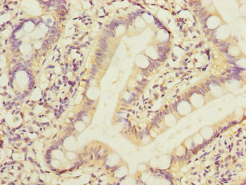 PPM1D Antibody