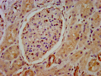 HIP1R Antibody