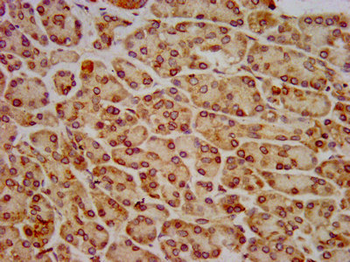 HIP1R Antibody