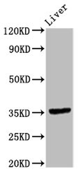 EPCAM Antibody