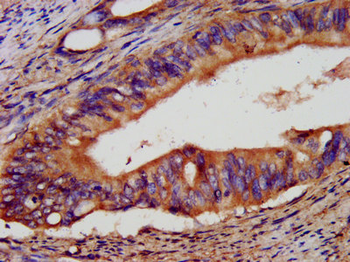 EPCAM Antibody