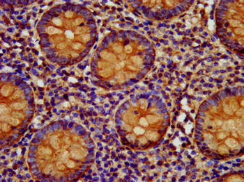 EPCAM Antibody