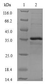 Human CTNNBIP1 protein