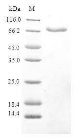 Human RRM2B protein