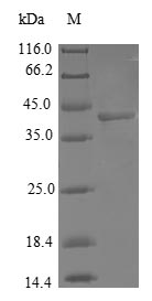 Human COX7A2L protein