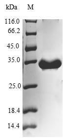 Human UQCR10 protein