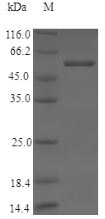 human CYP11B2 protein