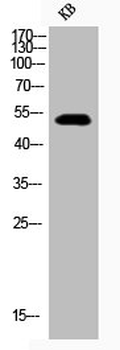GSK3A/GSK3B Antibody