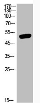 GSK3A/GSK3B Antibody