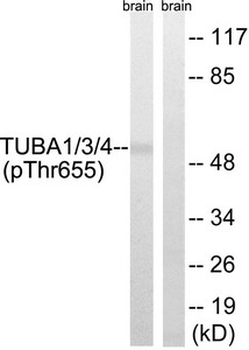 TUBA1A/TUBA1B/TUBA1C/TUBA3C/TUBA3E Antibody