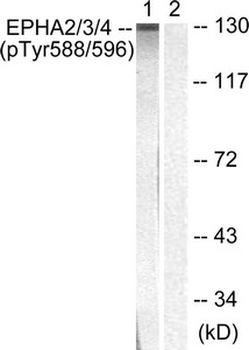 EPHA2/EPHA3/EPHA4 Antibody
