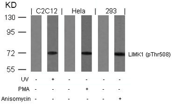 LIMK1 Antibody