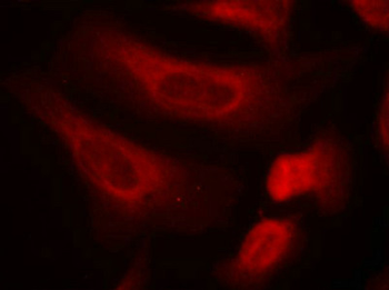 STAT1 Antibody