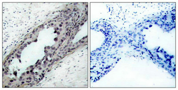 PTEN Antibody
