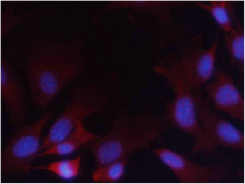 PTEN Antibody