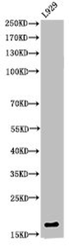 HIST1H3A/HIST2H3A/H3F3A Antibody