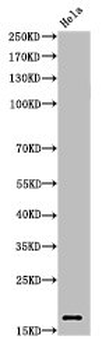 HIST1H3A/HIST2H3A/H3F3A Antibody