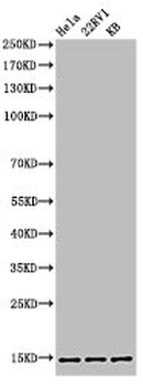 HIST1H3A/HIST2H3A/H3F3A Antibody