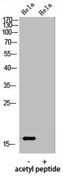 HIST1H3A/HIST2H3A/H3F3A Antibody