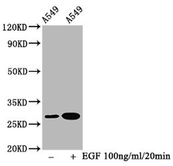 HSPB1 Antibody