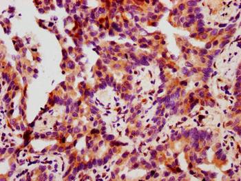 HSPB1 Antibody
