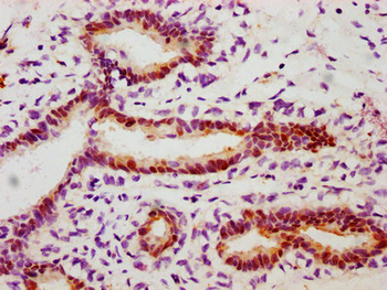 HSPB1 Antibody