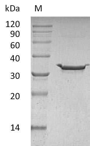 Human CA5B protein