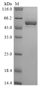 Human CYP1A1 protein