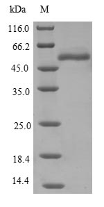 Human EPHX1 protein