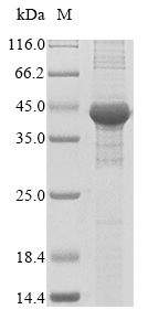 Human FASN FAS protein