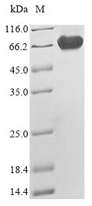 Human NF2 protein