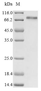 Human YAP1 protein
