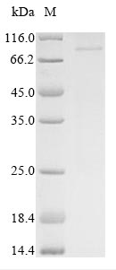 Human CTNNB1 protein