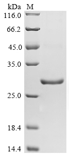 Animal Schistosoma japonicum Glutathione S-transferase class-mu 26 kDa isozyme protein