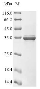 Human MT-CO1 protein
