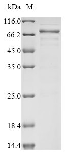 Human CHRNA1 protein