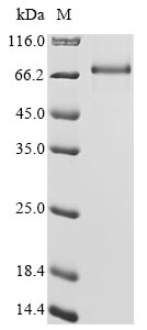 Human MDM4 protein