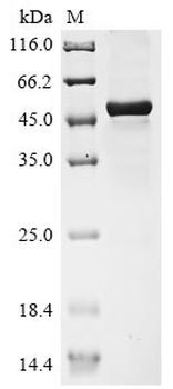 Human Ebi3 protein