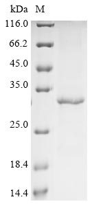 Human CDK5 protein