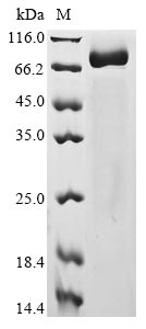 Human coronavirus NL63 Spike glycoprotein protein
