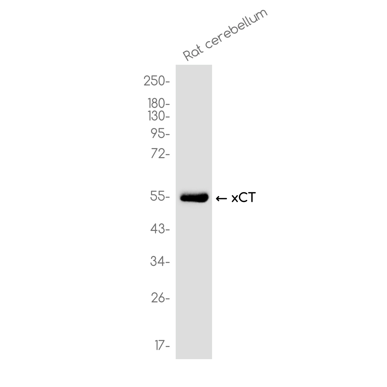XCT Rabbit Monoclonal Antibody